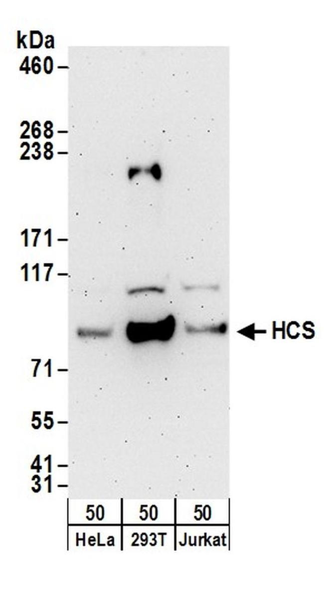 HCS Antibody in Western Blot (WB)