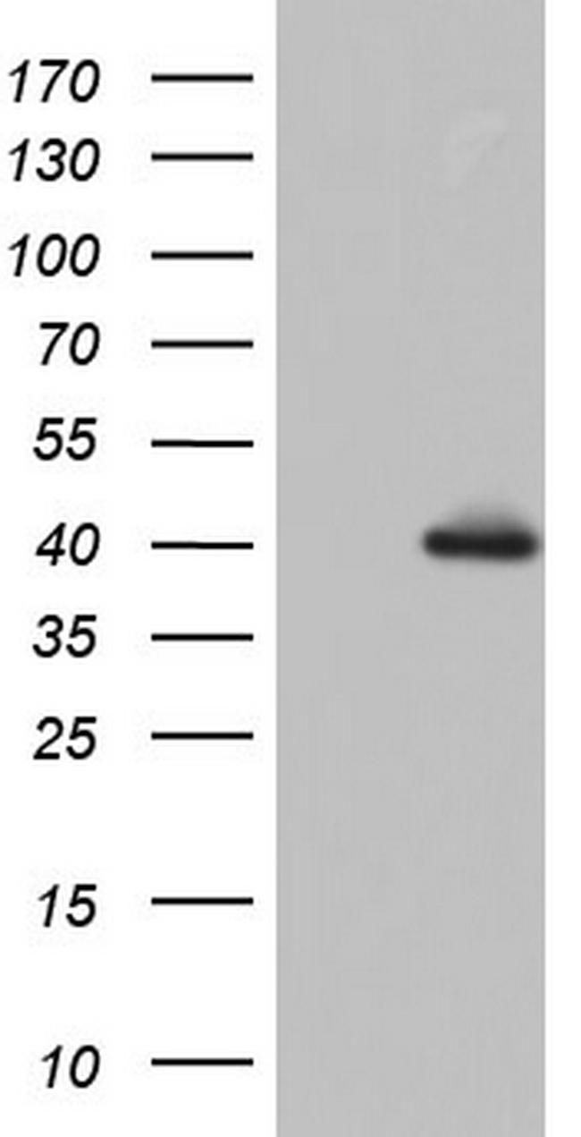 HDAC11 Antibody in Western Blot (WB)