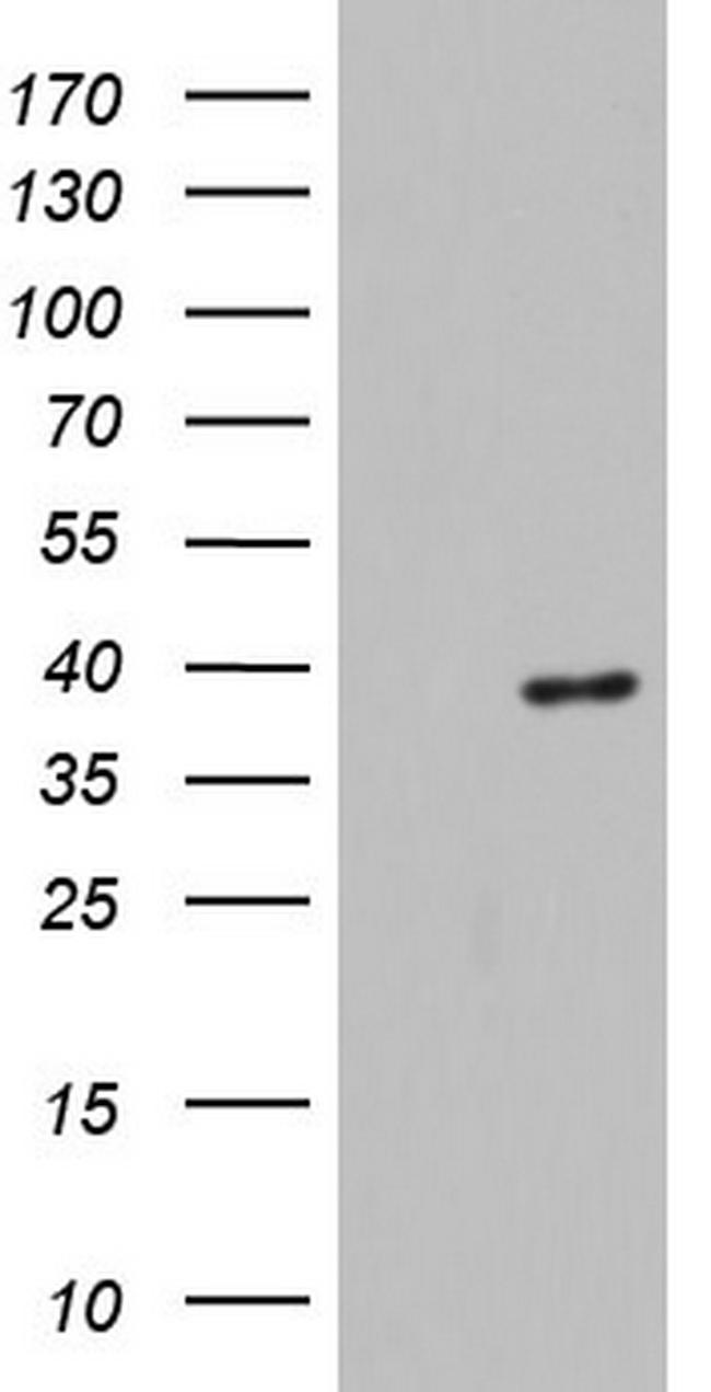 HDAC11 Antibody in Western Blot (WB)