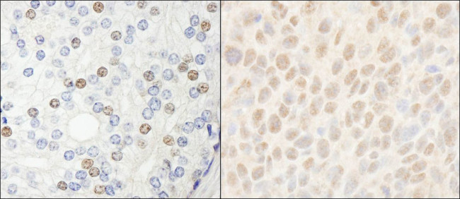 HDAC7 Antibody in Immunohistochemistry (IHC)