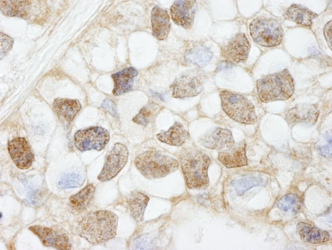 HDAC7 Antibody in Immunohistochemistry (IHC)