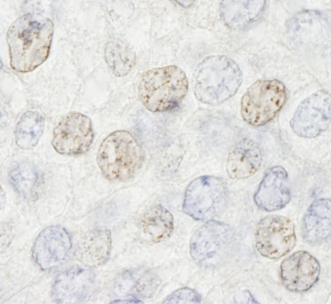 HDAC7 Antibody in Immunohistochemistry (IHC)