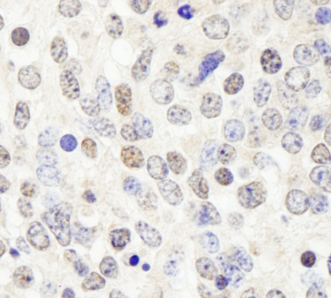 HDAC7 Antibody in Immunohistochemistry (IHC)