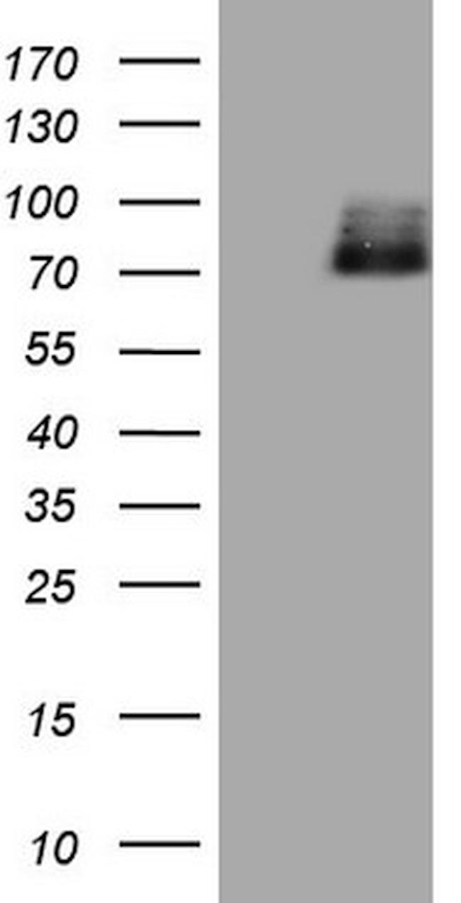 HIPK1 Antibody in Western Blot (WB)