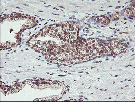 HLCS Antibody in Immunohistochemistry (Paraffin) (IHC (P))