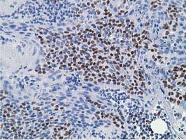 HOXC11 Antibody in Immunohistochemistry (Paraffin) (IHC (P))