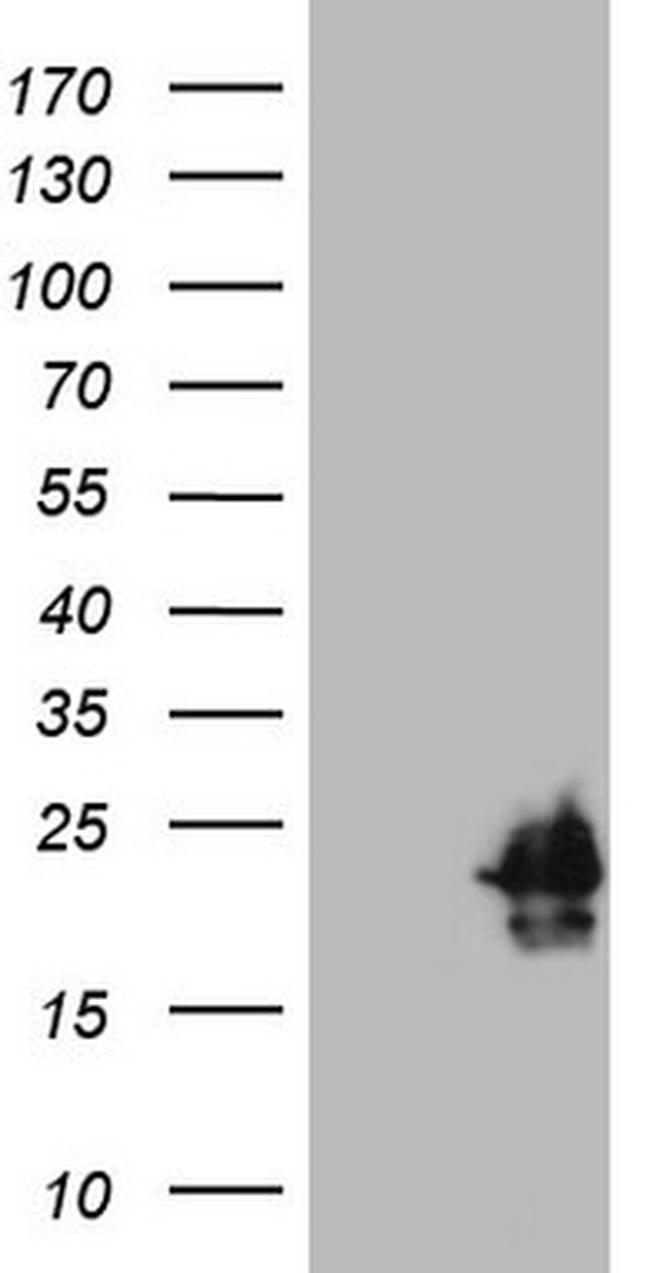 HPCAL4 Antibody in Western Blot (WB)