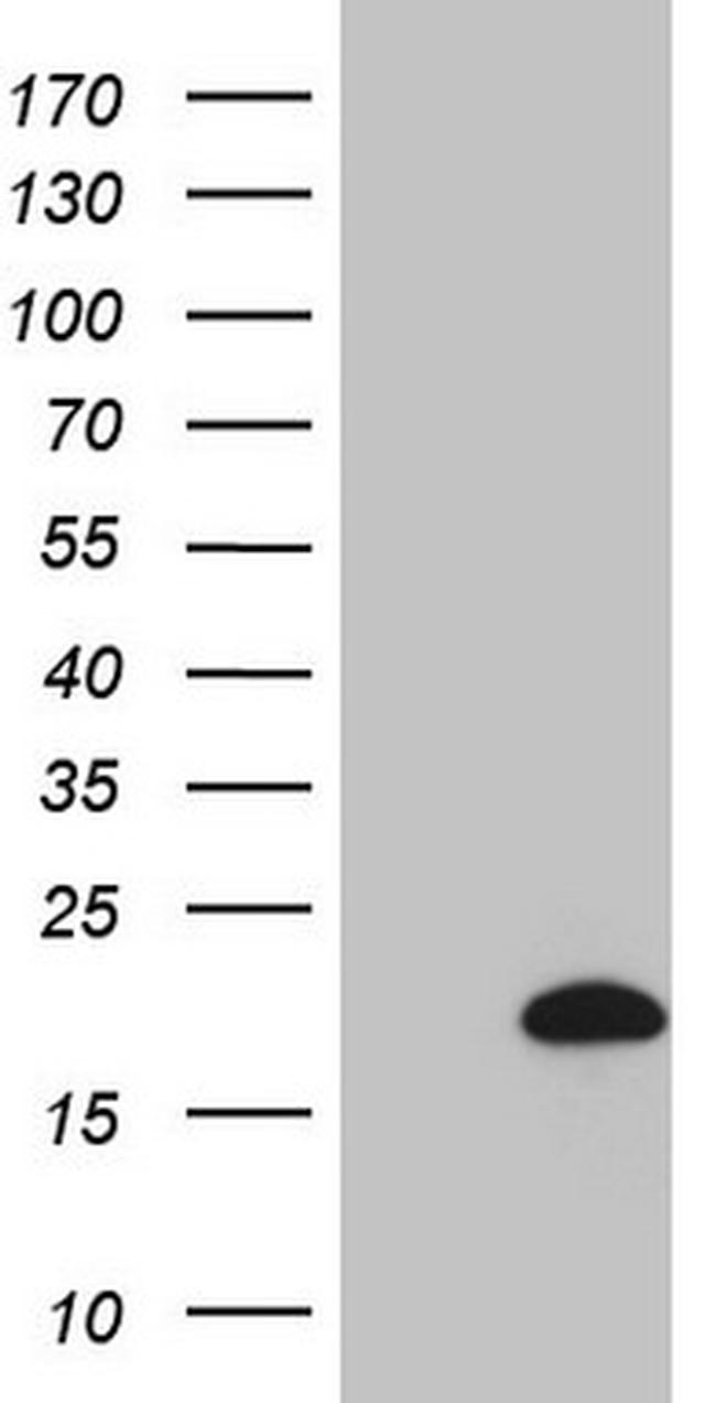 HPCAL4 Antibody in Western Blot (WB)