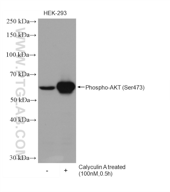 Phospho-AKT (Ser473) Antibody in Western Blot (WB)