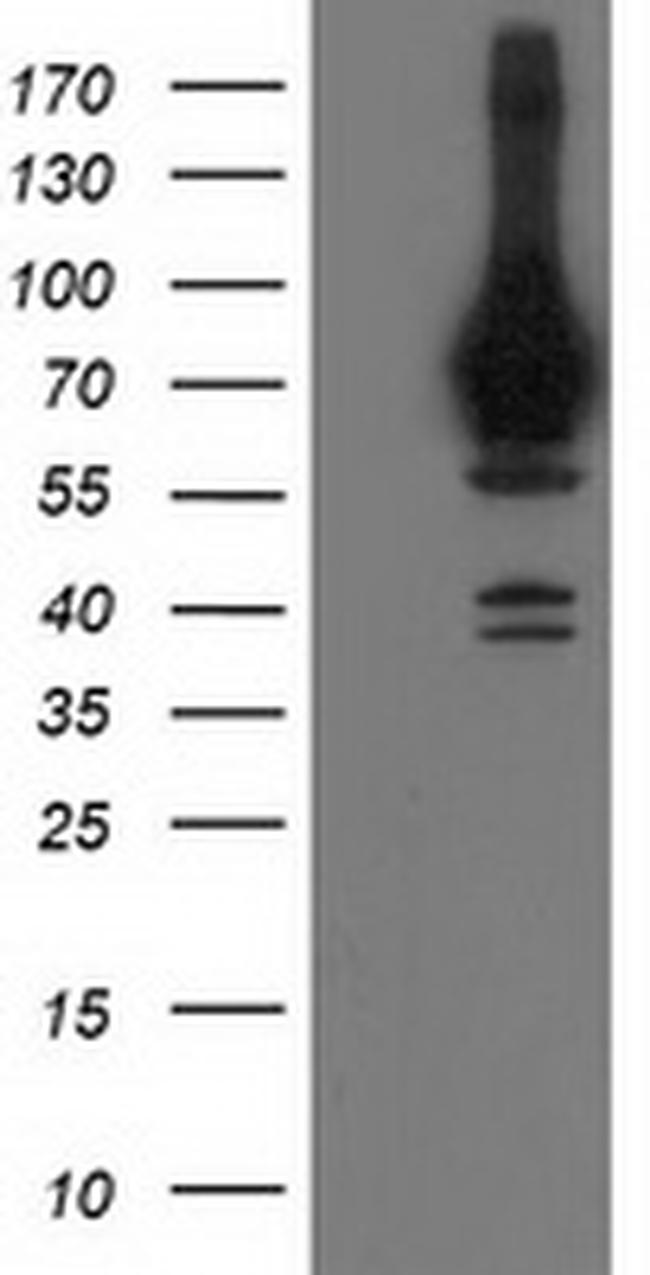 HSPA6 Antibody in Western Blot (WB)