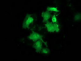 HSPB8 Antibody in Immunocytochemistry (ICC/IF)