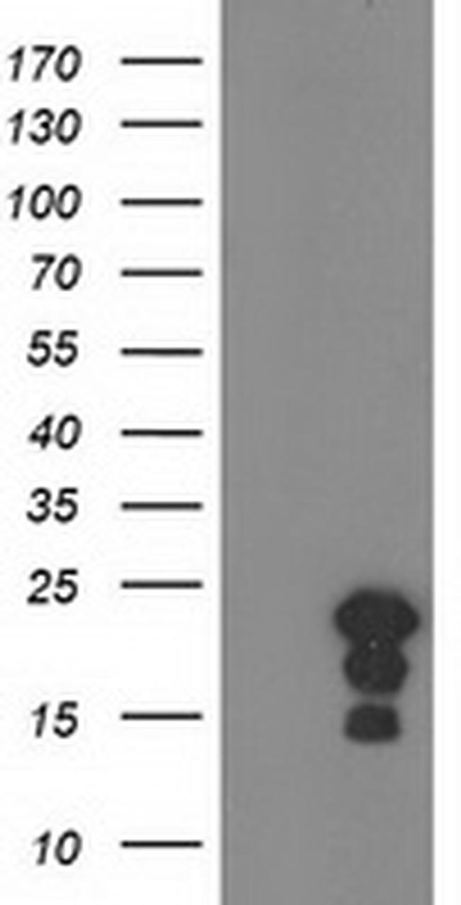 HSPB8 Antibody in Western Blot (WB)