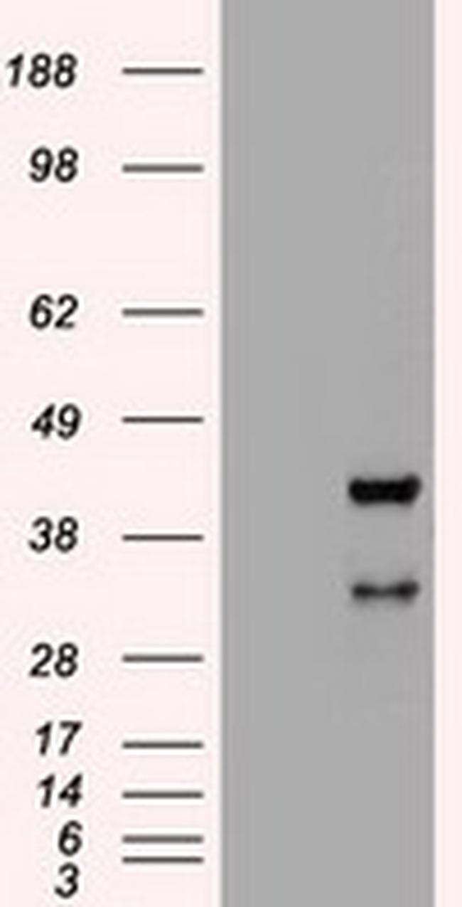 Hex Antibody in Western Blot (WB)