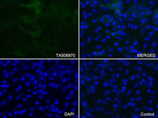 ICAM1 Antibody in Immunocytochemistry (ICC/IF)