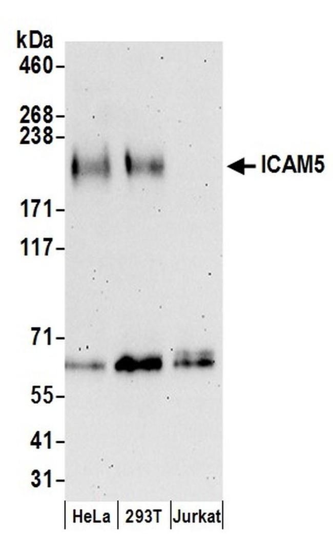 ICAM5 Antibody in Western Blot (WB)