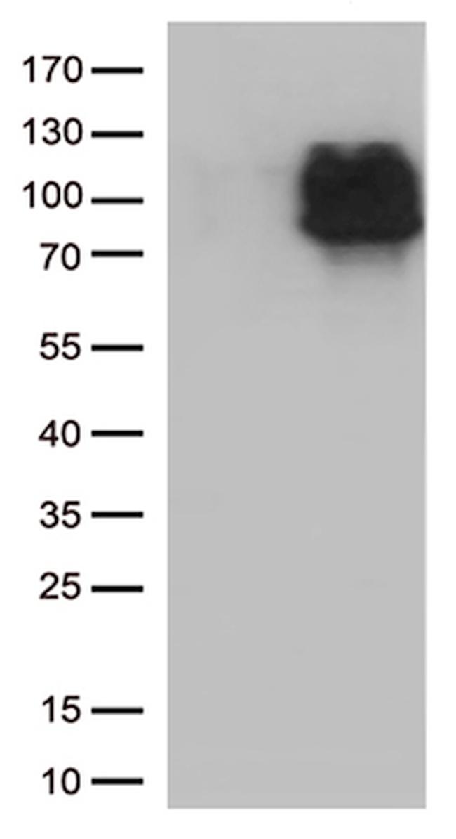 IFNLR1 Antibody in Western Blot (WB)