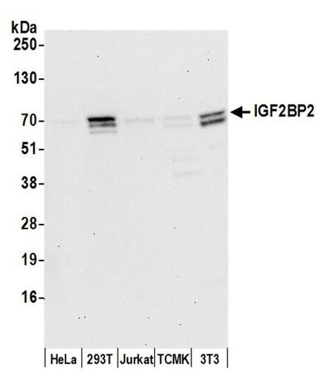 IGF2BP2 Antibody in Western Blot (WB)