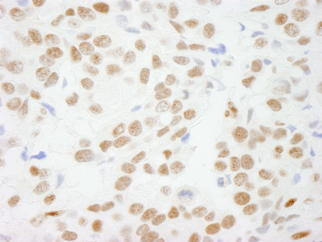 CTBP1 Antibody in Immunohistochemistry (Paraffin) (IHC (P))