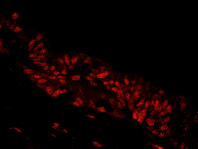 NBS1 Antibody in Immunohistochemistry (Paraffin) (IHC (P))