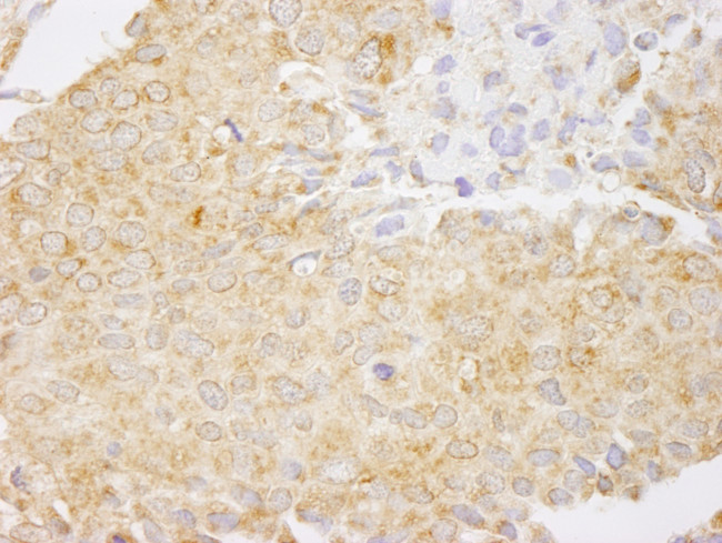 NF-kappaB1 Antibody in Immunohistochemistry (Paraffin) (IHC (P))