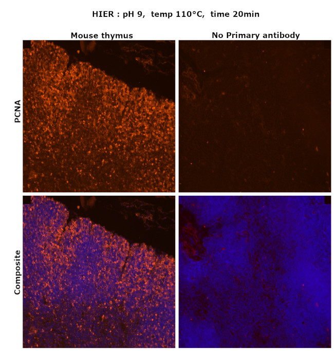 PCNA Antibody in Immunohistochemistry (Paraffin) (IHC (P))