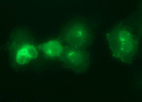 IL6R Antibody in Immunocytochemistry (ICC/IF)