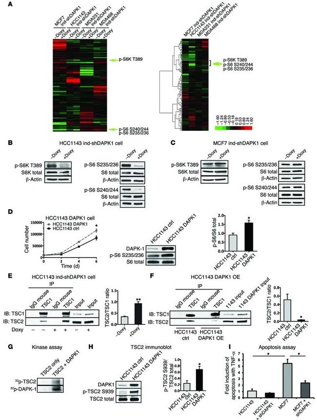 TSC2 Antibody in Immunoprecipitation (IP)