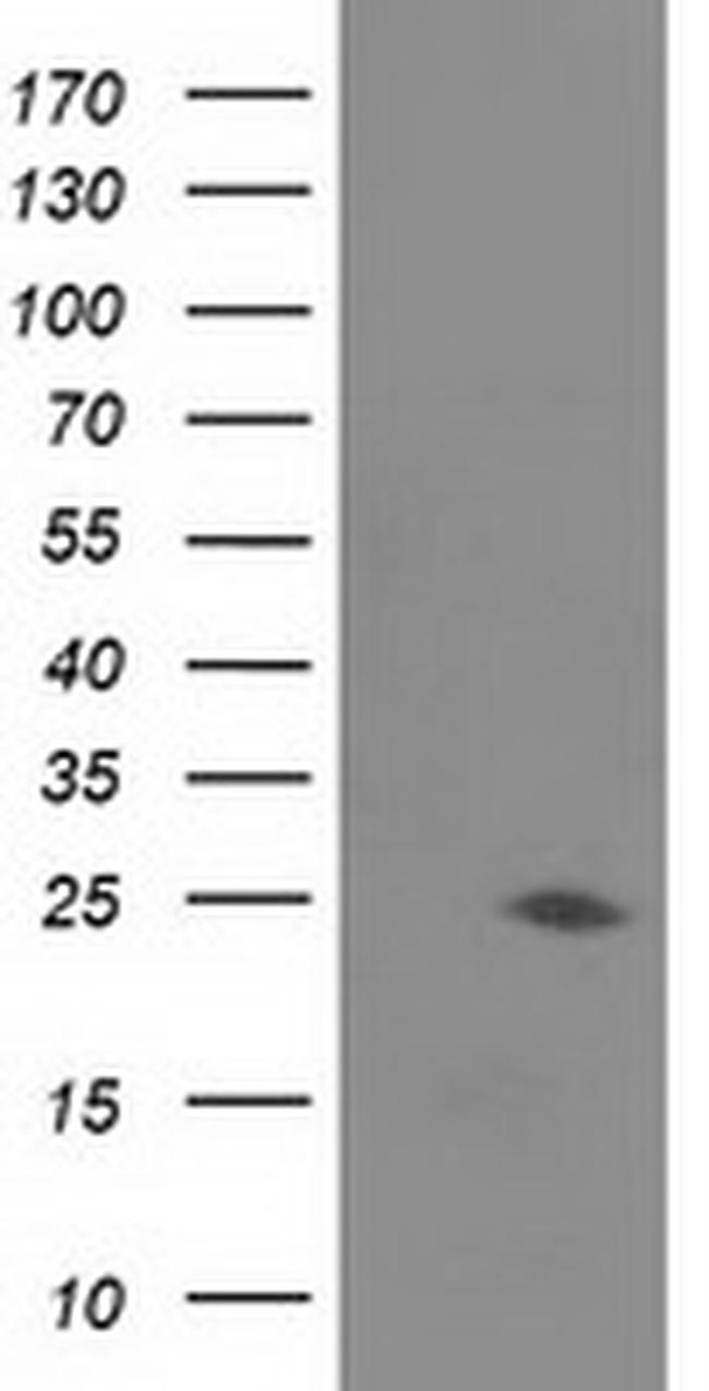 JOSD1 Antibody in Western Blot (WB)