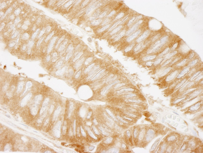 KARS Antibody in Immunohistochemistry (IHC)