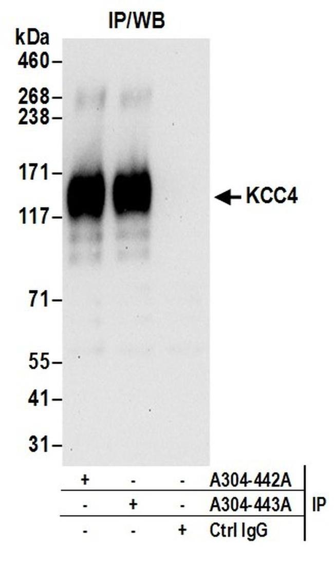 KCC4 Antibody in Western Blot (WB)