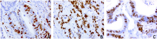 KI67 Antibody in Immunohistochemistry (Paraffin) (IHC (P))