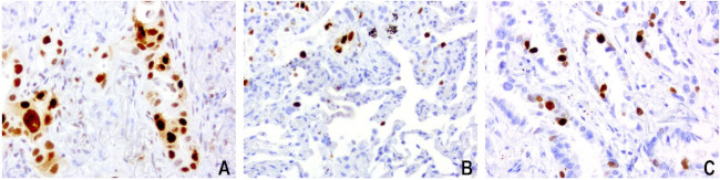 KI67 Antibody in Immunohistochemistry (Paraffin) (IHC (P))