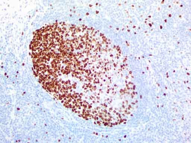 KI67 Antibody in Immunohistochemistry (Paraffin) (IHC (P))