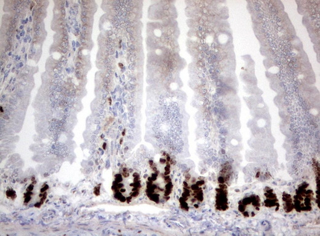 KI67 Antibody in Immunohistochemistry (Paraffin) (IHC (P))