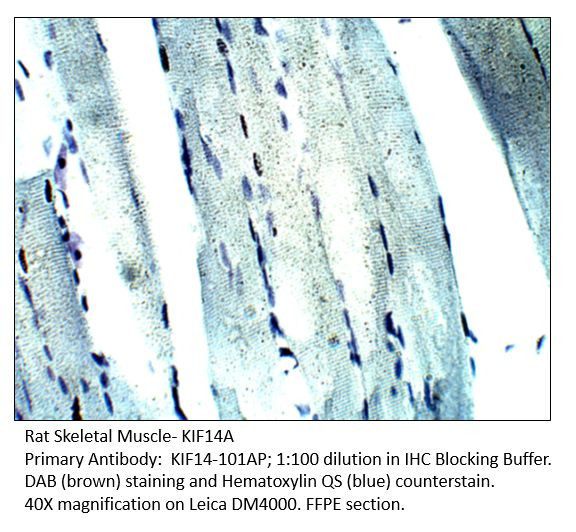 KIF14 Antibody in Immunohistochemistry (IHC)