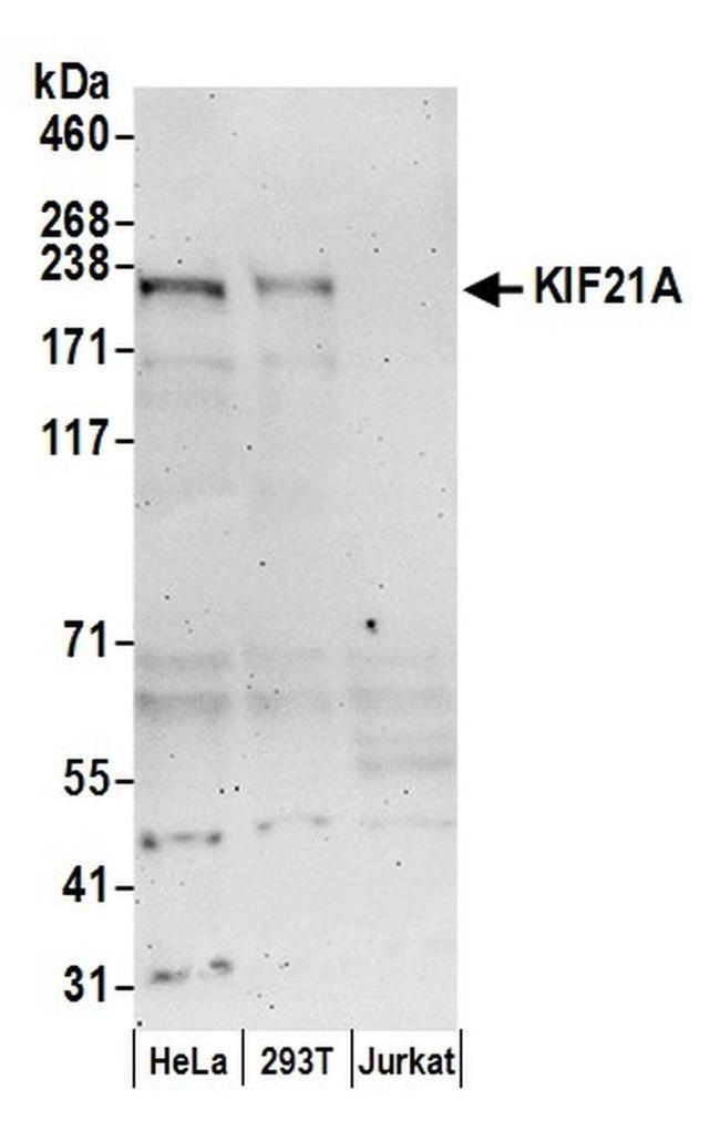 KIF21A Antibody in Western Blot (WB)