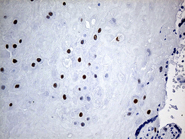 KLF5 Antibody in Immunohistochemistry (Paraffin) (IHC (P))