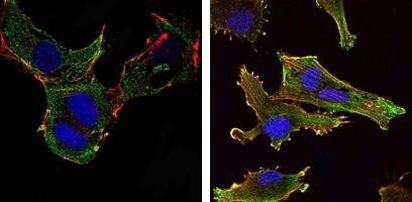 KLHL13 Antibody in Immunocytochemistry (ICC/IF)