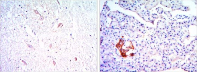 KLHL13 Antibody in Immunohistochemistry (Paraffin) (IHC (P))