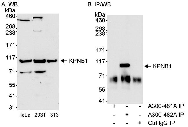 KPNB1 Antibody in Western Blot (WB)