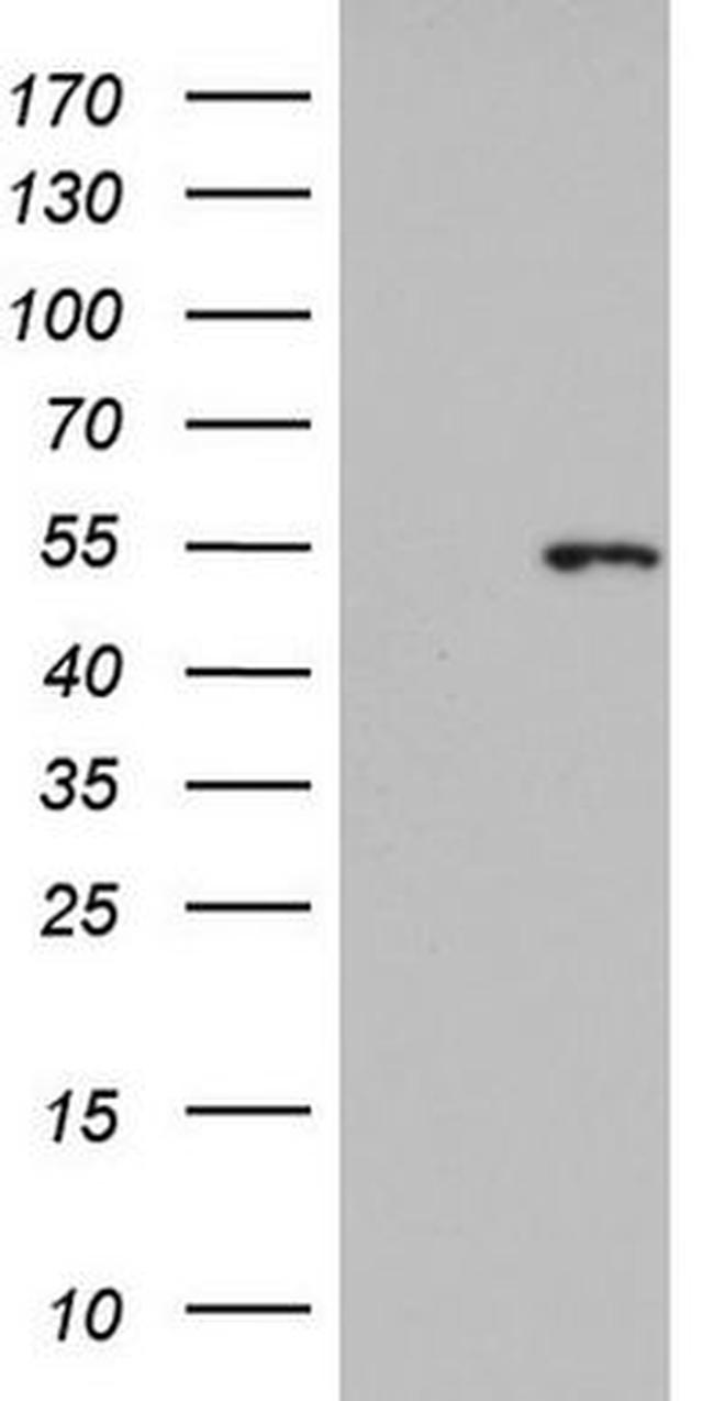 KRT14 Antibody in Western Blot (WB)