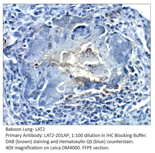 LAT2/NTAL Antibody in Immunohistochemistry (IHC)