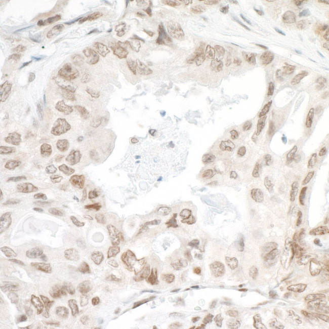 LEDGF/p75 Antibody in Immunohistochemistry (IHC)