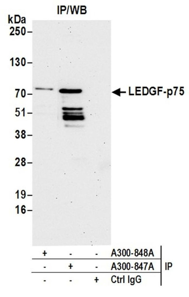 LEDGF/p75 Antibody in Immunoprecipitation (IP)