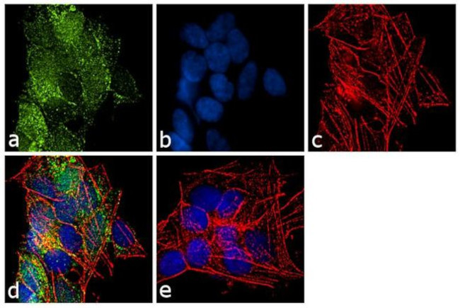 Ubiquitin Antibody in Immunocytochemistry (ICC/IF)