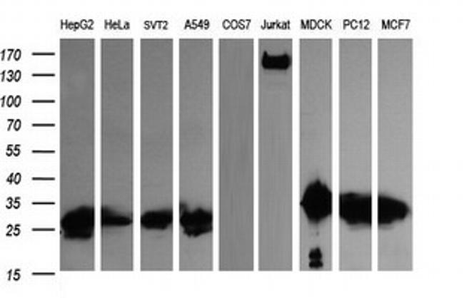 LGALS3 Antibody in Western Blot (WB)