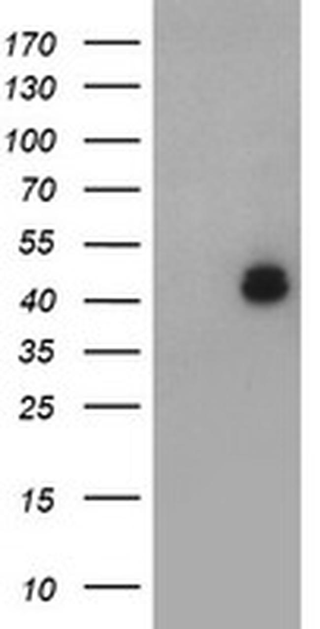 LHX1 Antibody in Western Blot (WB)