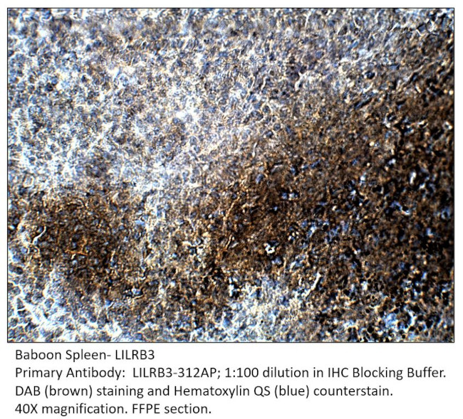 LILRB3 Antibody in Immunohistochemistry (IHC)