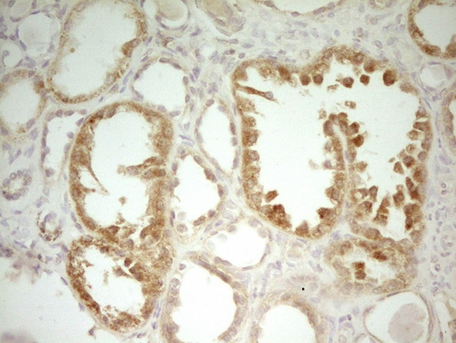 LIME1 Antibody in Immunohistochemistry (Paraffin) (IHC (P))