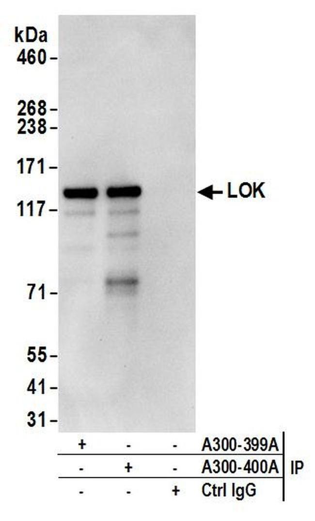 LOK Antibody in Western Blot (WB)